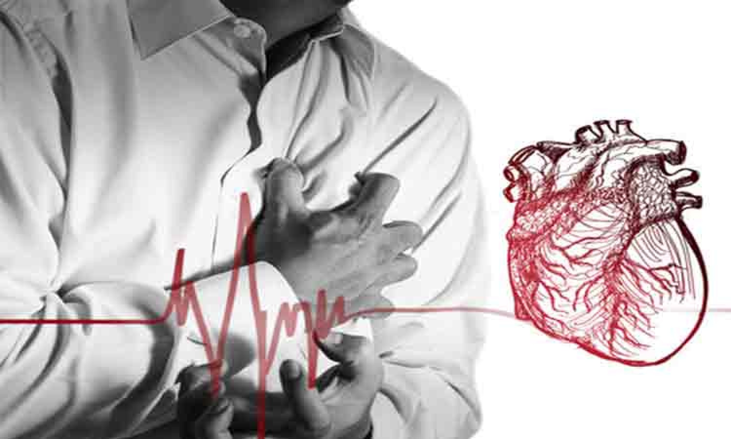 5 rizikófaktor a szívroham kialakulásához - sokan figyelmen kívül hagyják