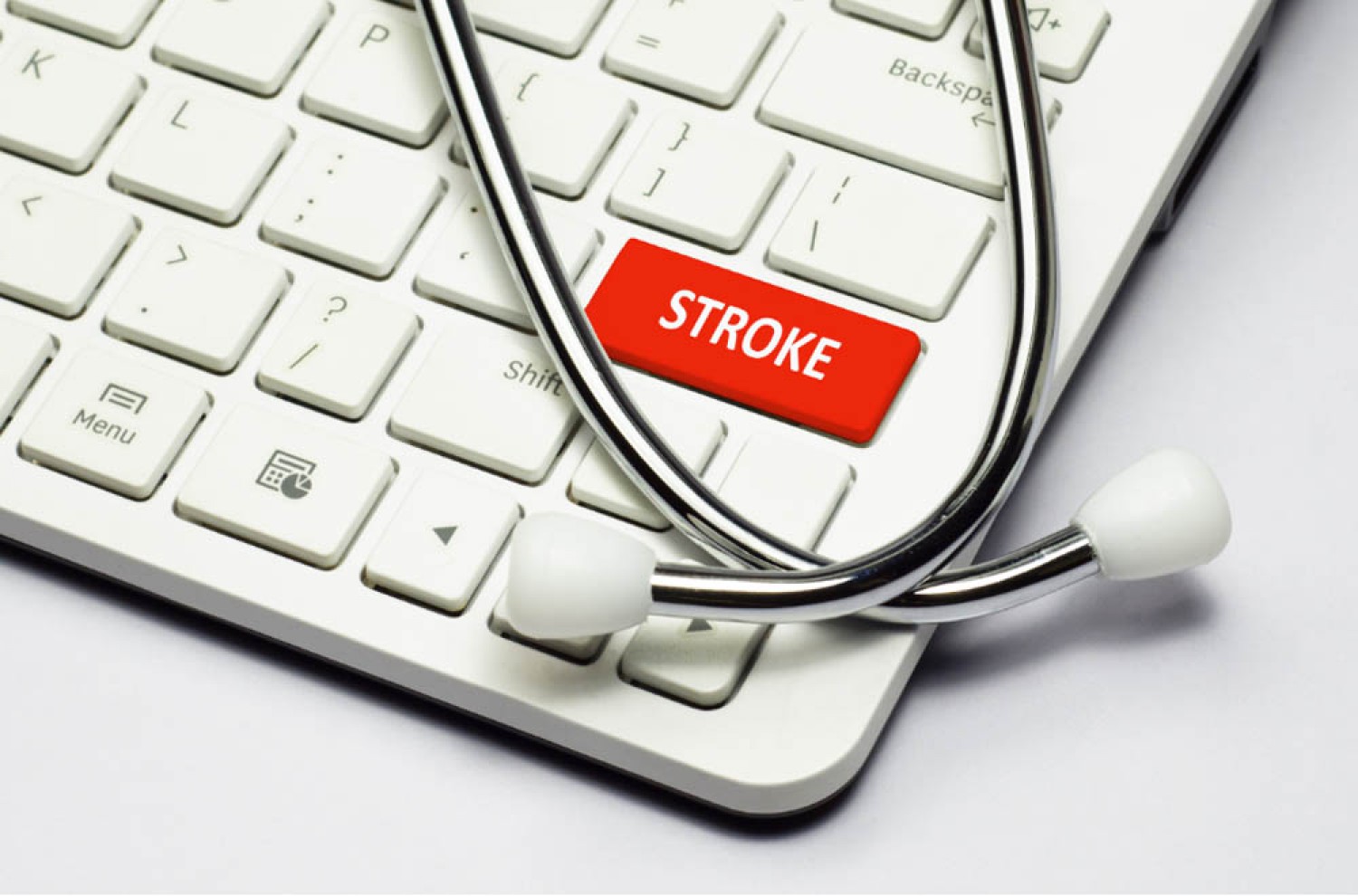 4-ből 1 ember érintett lehet élete során stroke-ban
